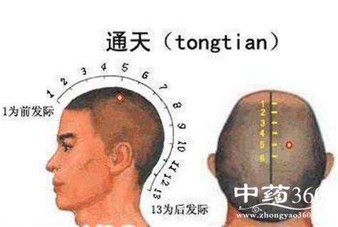 通天穴|通天穴的准确位置图和作用